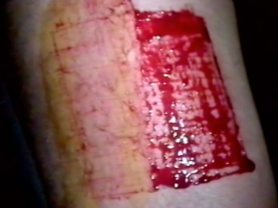 5. Mike Parr Black Square Tcb 2015